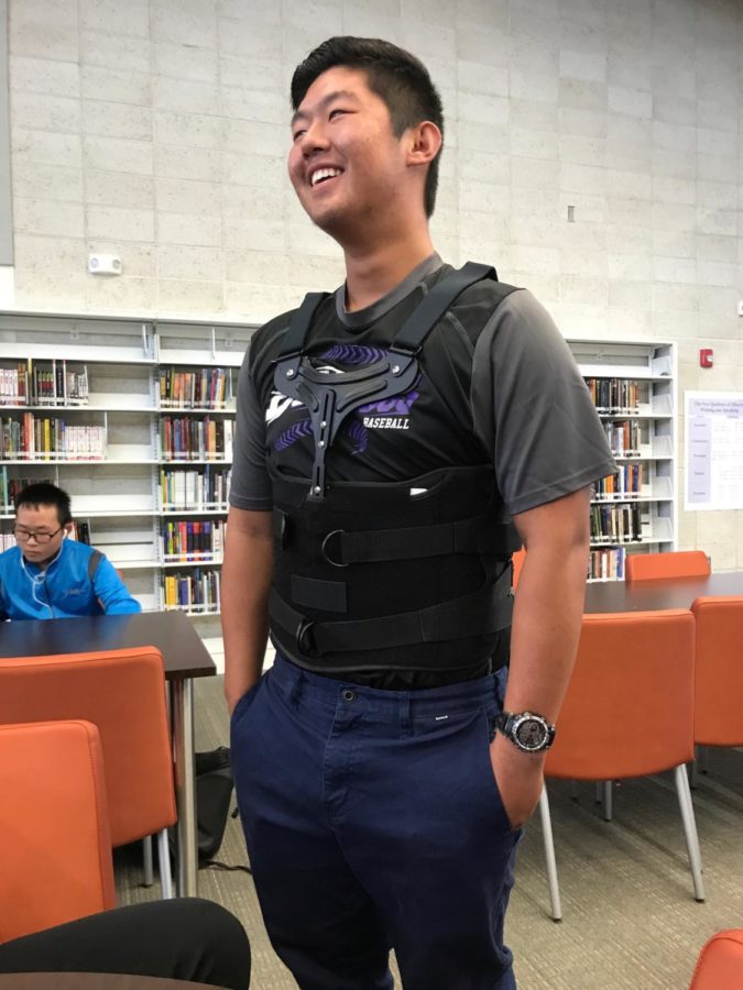Junior Anthony Lu has sustained many injuries throughout his life, however these injuries have not diminished his love for baseball at all.