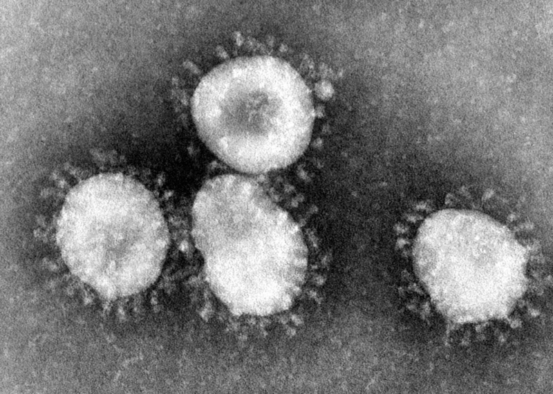 This is of the SARS strain of coronavirus. Experts believe the 2019-nCoV coronavirus originated in bats and spread to humans.